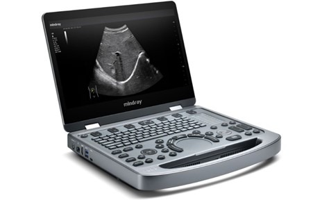 Mindray MX5 Mobile ultrasound